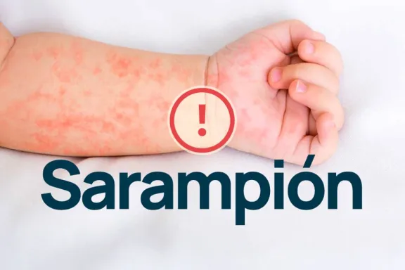 Posible caso de sarampión y otro confirmado de tos convulsa en el país.